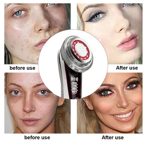 Face Skin EMS Mesotherapy Electroporation